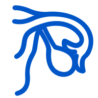 卵巢癌